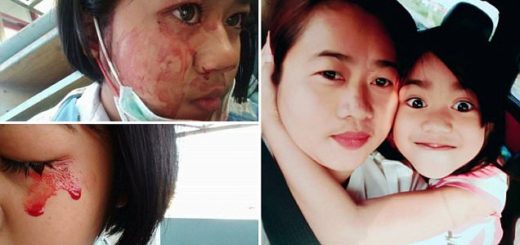 Gadis Ini Terus Mengeluarkan Darah Saat Sakit Kepala